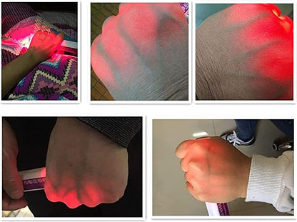 Détecteur de veine VascuLight™