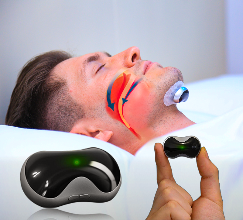 SilentEase – Dispositif Anti-Ronflement pour des Nuits Paisibles